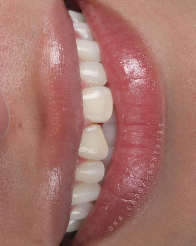 Ceramico-6