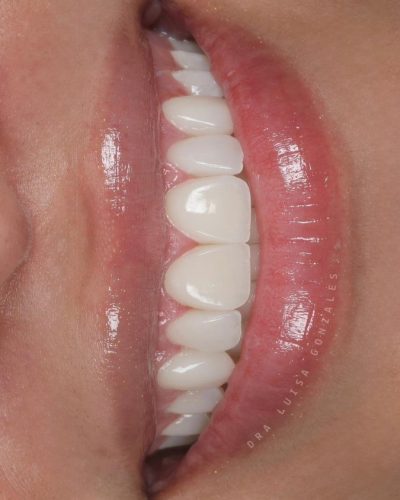 Ceramico-7