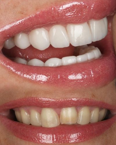 Ceramico-8